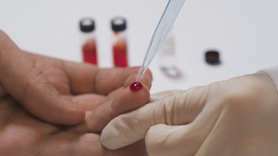 手指血液测试。医生从病人的手指上取血作分析。