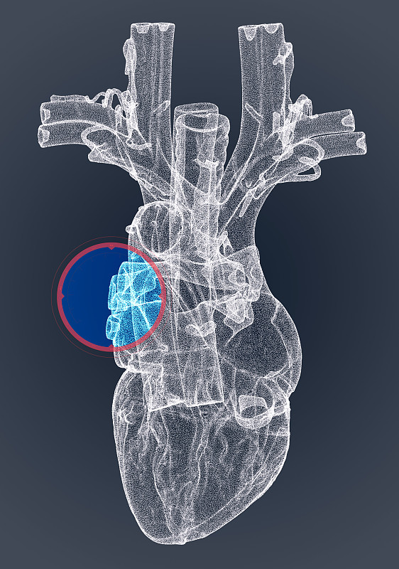 心脏，心室，人体解剖学，心室。人体的部分。x射线的观点。住房和城市发展部。先进的科学设备。全息图。扫