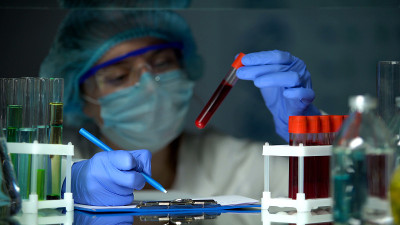 科学家对试管进行血液分析并做了记录，疫情爆发