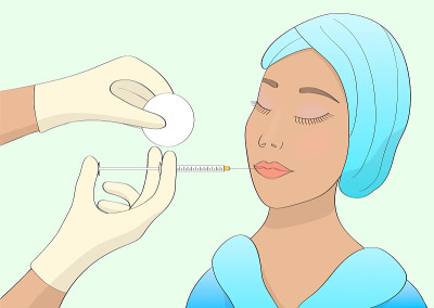这个女孩做了隆唇手术