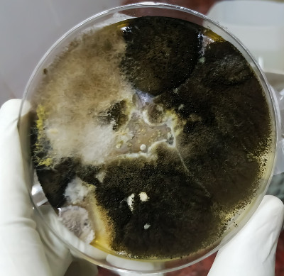 近距离观察培养皿，用麦芽提取物琼脂作生长介质，分离培养酵母菌、霉菌，在医疗卫生实验室检测青霉菌分析疾