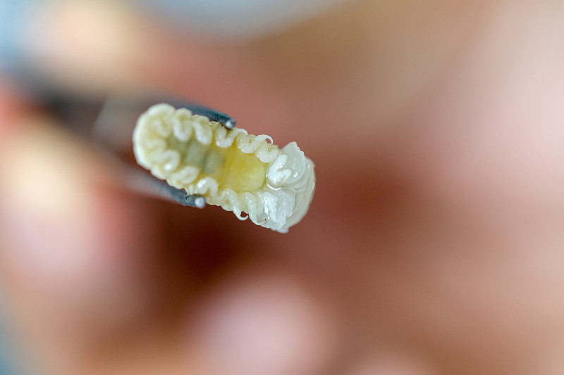 等足类(甲壳纲)，等足类生活在海洋中，在淡水中，等足类有壳质外骨骼和关节四肢，用于实验室教育。