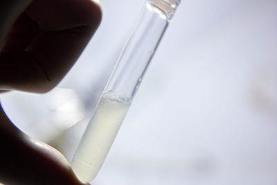 在医疗中心做精液分析精子在体外。