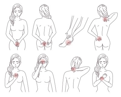 女性身体疼痛带设置，矢量插图。病人身体部位有红色痛点的部位。