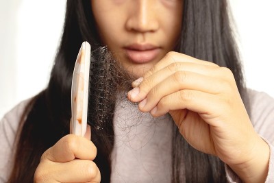 女性对洗发水过敏会导致脱发和头皮屑。