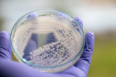 培养皿酵母菌，实验室微生物学教育。