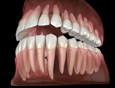 人类下颌和上颌牙龈和牙齿的形态。医学上准确的牙齿3D插图