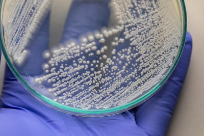 培养皿酵母菌，实验室微生物学教育。