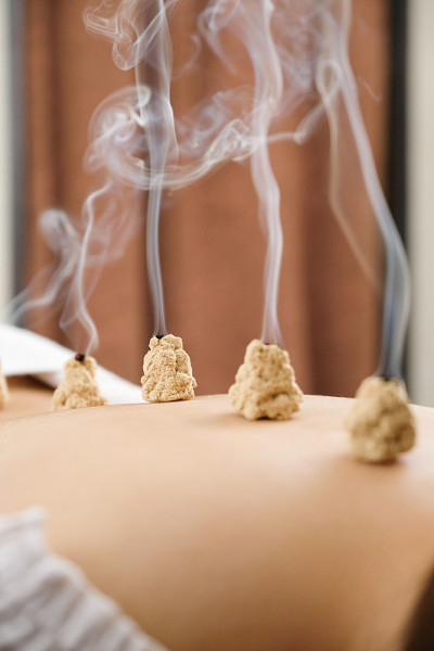 在一个女人的背部针灸亮针中心