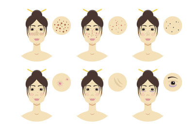 有皮肤问题，粉刺的女人。矢量图