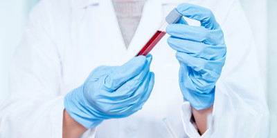 本研究是用于诊断医疗保健的血浆生物医学
