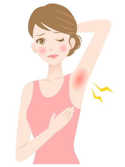 woman’s armpit hair removal. underarm red rash. be