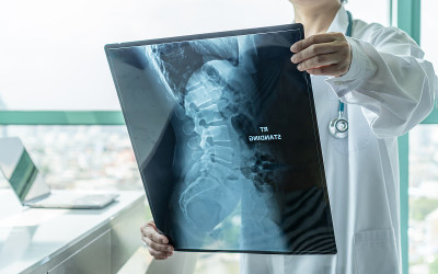 外科医生通过对脊柱疾病、骨癌疾病、脊肌萎缩等病人的x光片进行医学诊断，提出医疗保健的概念