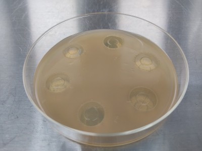 微生物培养结果观察