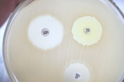 细菌的抗生素敏感性扩散试验是一种试验方法。微生物学