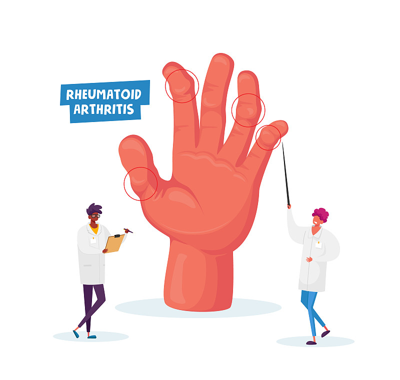 Rheumatoid Arthritis. Doctor Arthrologist Pointing