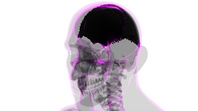 医学概念的人类骨骼、颅骨顶骨解剖
