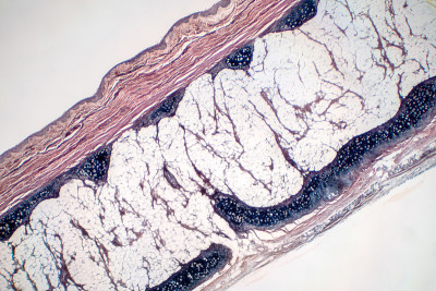 教育病理显微镜下观察人透明软骨骨。人体组织phisiology。