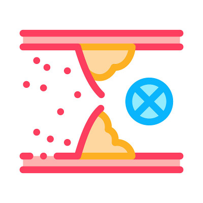 血管阻塞彩色图标矢量插图