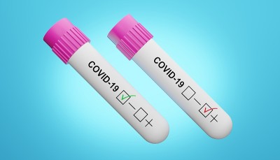 covid-19检测阴性和阳性的3D渲染。危及生命的Covid-19病毒爆发的医学概念。医学用数字图