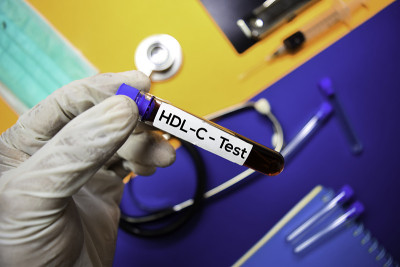 用血样进行HDL-C检测。顶视图孤立的颜色背景。医疗保健/医学概念
