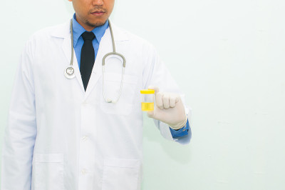 医生拿着医学尿检，特写
