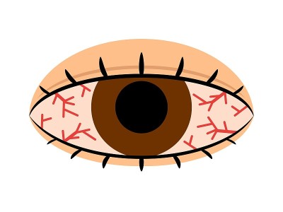 眼充血