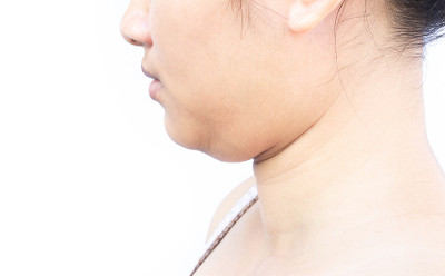 特写女人胖上第二下巴，保健美容理念