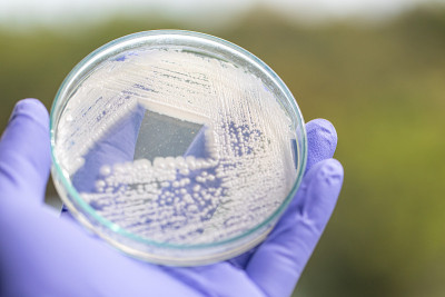培养皿酵母菌，实验室微生物学教育。
