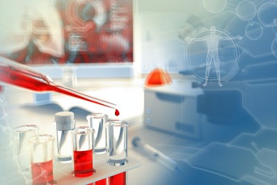 医学3D插图，大学设施的证明瓶-具有创造性梯度覆盖的单核细胞或艾滋病毒的血液基因测试