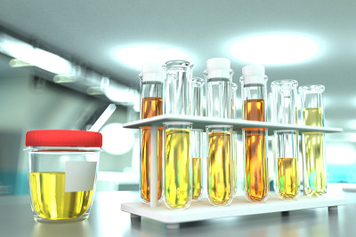 现代微生物学临床的实验室证明-尿液结晶或感染的质量检测，医学3D插图