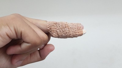 手指矫形器或稳定器(铝夹板)是一种用于固定和支持手指的医疗器械，用于治疗骨折、锤状指和肌腱炎。医疗设