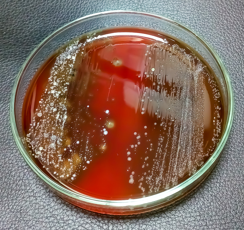 培养皿中。微生物实验室。肠杆菌在血琼脂培养基上的菌落。细菌的研究