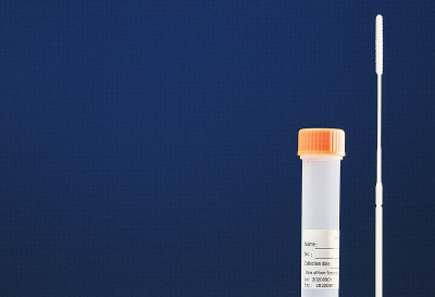 分析试验采用PCR法检测SARS-CoV-2 RNA，拭子，透明瓶，带数据贴，橙色封盖。蓝色背景。