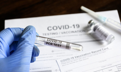 医生交诊时COVID-19 PCR检测