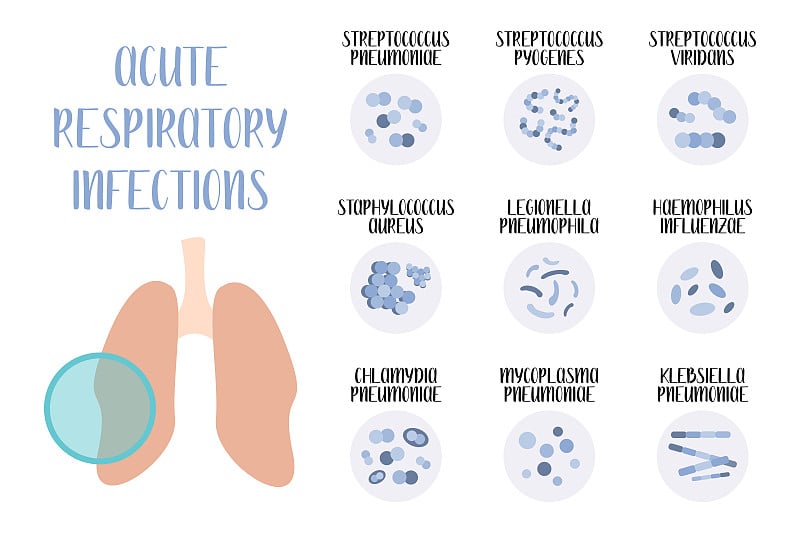 急性呼吸道感染。致病菌(球菌、杆菌)。形态。微生物学。矢量平面插图