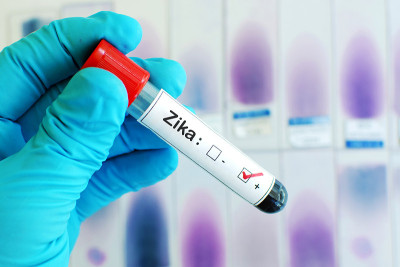 Zika病毒阳性