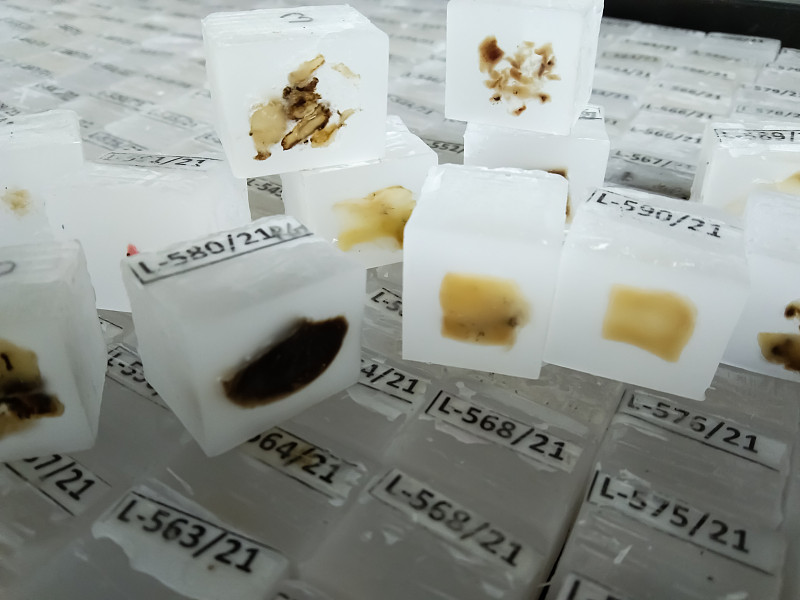 组织病理学组织标本石蜡切片。