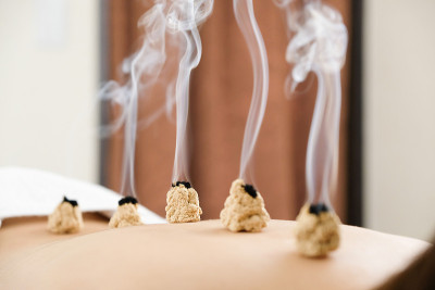 在一个女人的背部针灸亮针中心