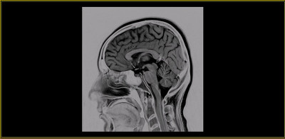 健康男性大脑MRI扫描(磁共振成像)高分辨率