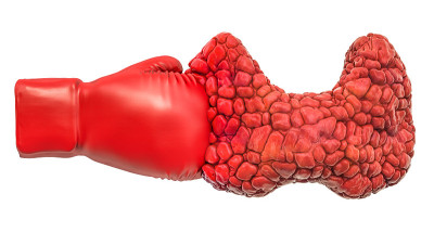 甲状腺疾病概念，在白色背景上分离的3D渲染