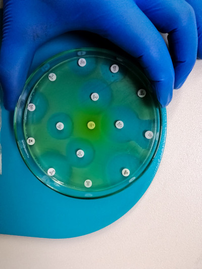 微生物实验室对铜绿假单胞菌的细菌敏感试验。