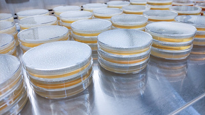 在微生物实验室进行培养皿菌落检测。