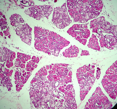 混合唾液Gland-Histology