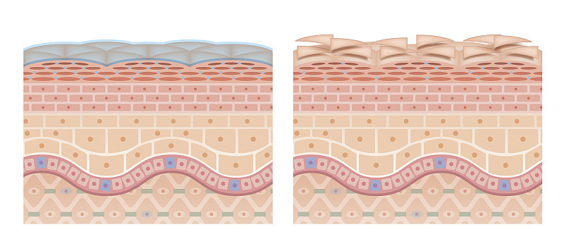 Cross section of the skin 4 front No commentary