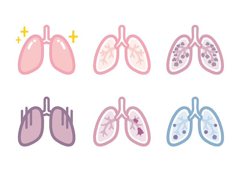 肺部疾病的插图