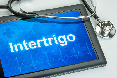 平板电脑与诊断Intertrigo显示