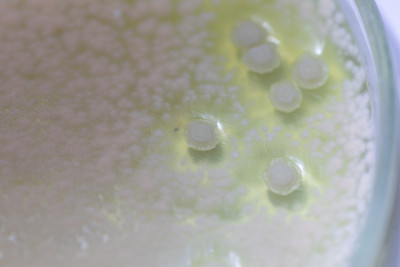 土壤样品琼脂平板上细菌和霉菌的特性及不同形态菌落背景，供微生物学实验室教学之用。