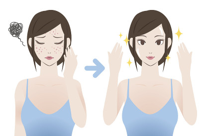 治疗前痤疮后图像插图