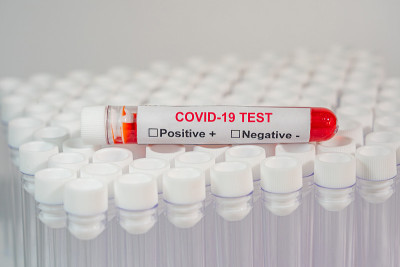 COVID-19感染血液检测样本特写照片